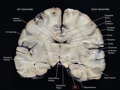 Anatomy and Connectivity of the Subthalamic Nucleus in Humans and Non-human Primates